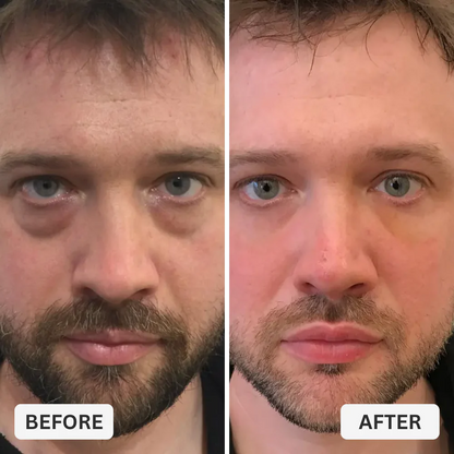 Zevorify Eye Repair Stick