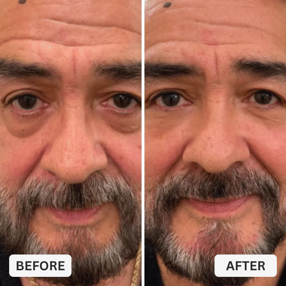 Zevorify Eye Repair Stick