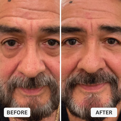 Zevorify Eye Repair Stick