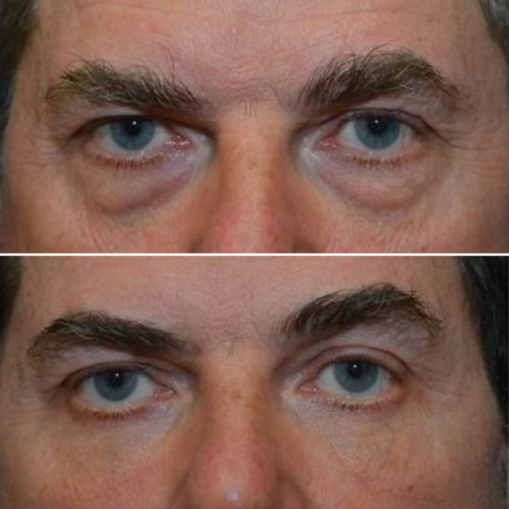 Zevorify Eye Repair Stick