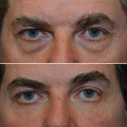 Zevorify Eye Repair Stick